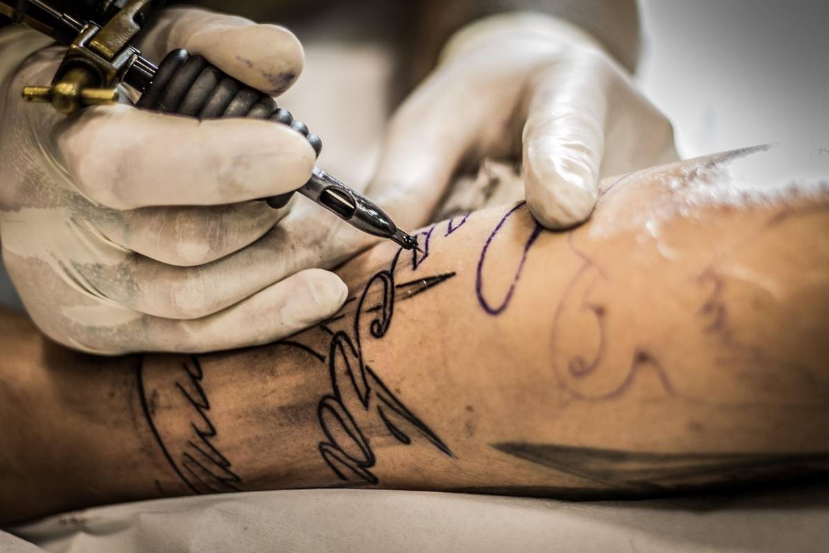 Come si rimuovono i tatuaggi: dal dolore, al tempo necessario. Tutto quello c'è da sapere