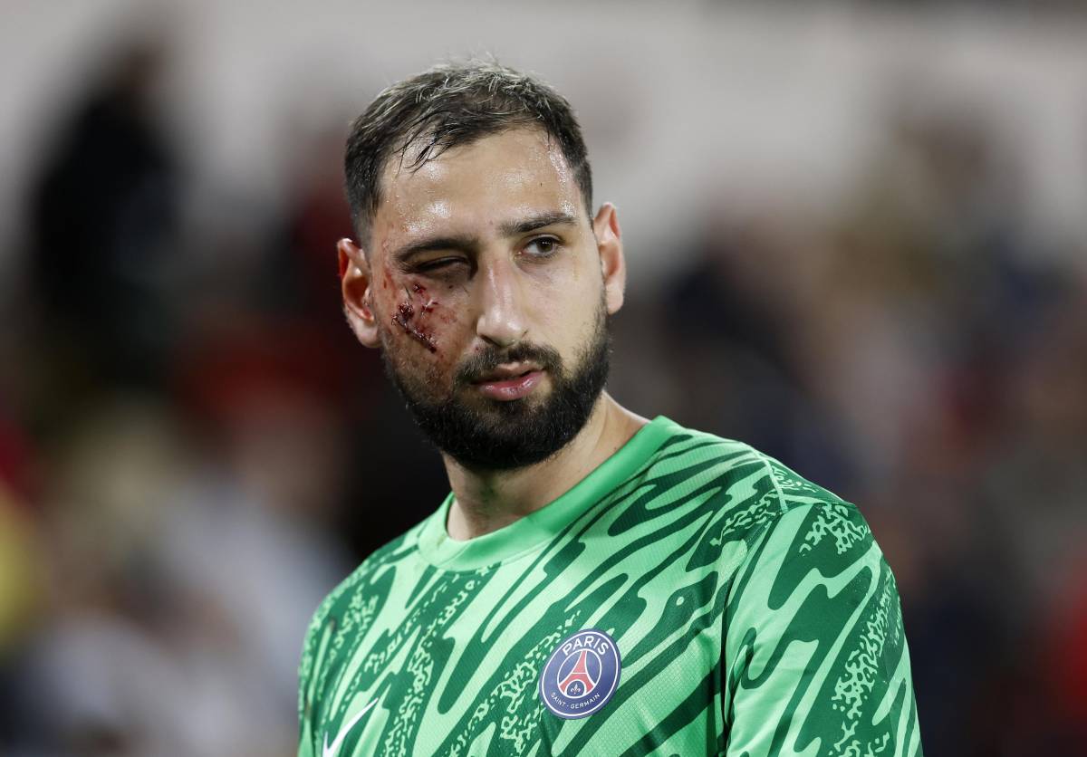 Quella cicatrice sul volto di Gigio che il PSG ha dimenticato troppo in fretta.