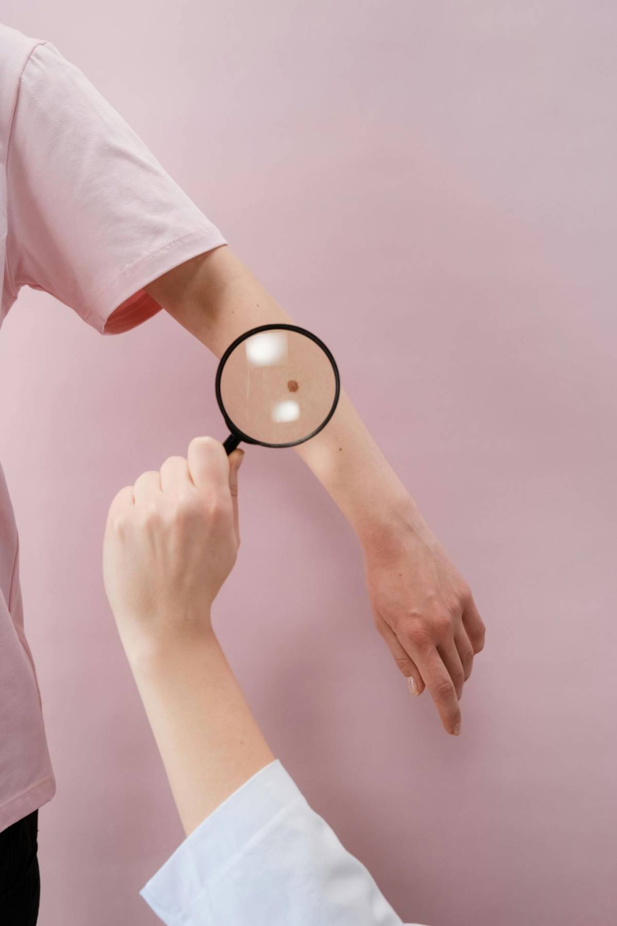 Estate e zecche: come riconoscere subito i sintomi della malattia di Lyme