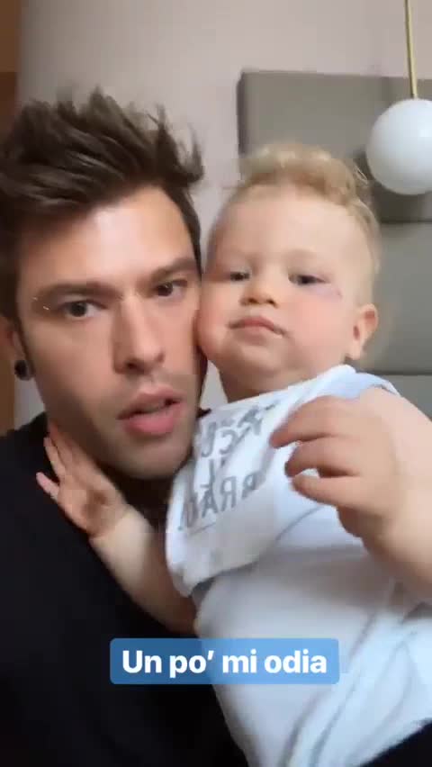 Fedez, Leone è caduto ed ha un occhio nero